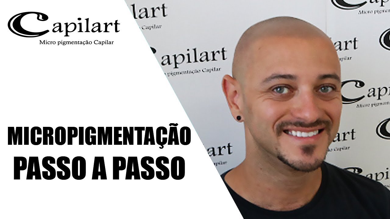 TODAS ETAPAS Micropigmentação capilar | Capilart