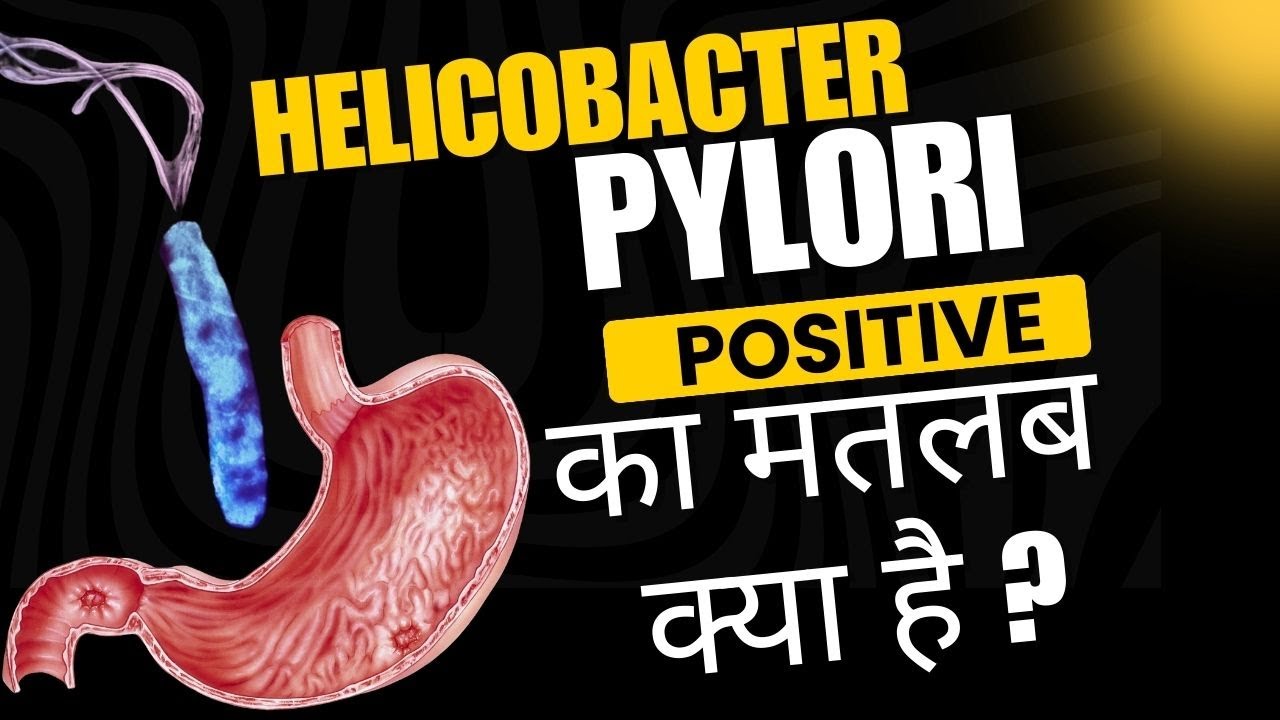 Helicobacter pylori positive means | H pylori test kya hota hai?