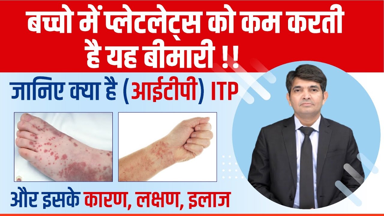 बच्चो में प्लेटलेट्स को कम करती है यह बीमारी ! जानिए क्या है ITP और इसके कारण, लक्षण, इलाज |
