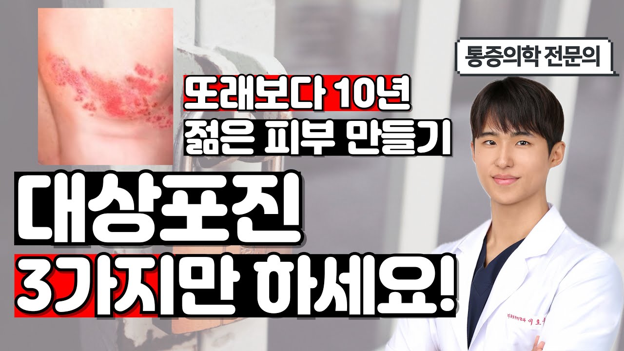 대상포진에 대한 모든것! 대상포진을 없애는 아주 쉬운 3가지 방법. 대상포진을 거의 100% 예방하는 방법부터 대상포진을 의심하는 3가지 증상까지. 이 영상에서 모두 설명해드려요.