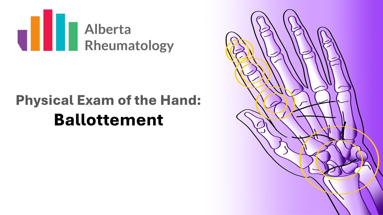 Rheumatology HAND exam: Palpation for Joint Swelling