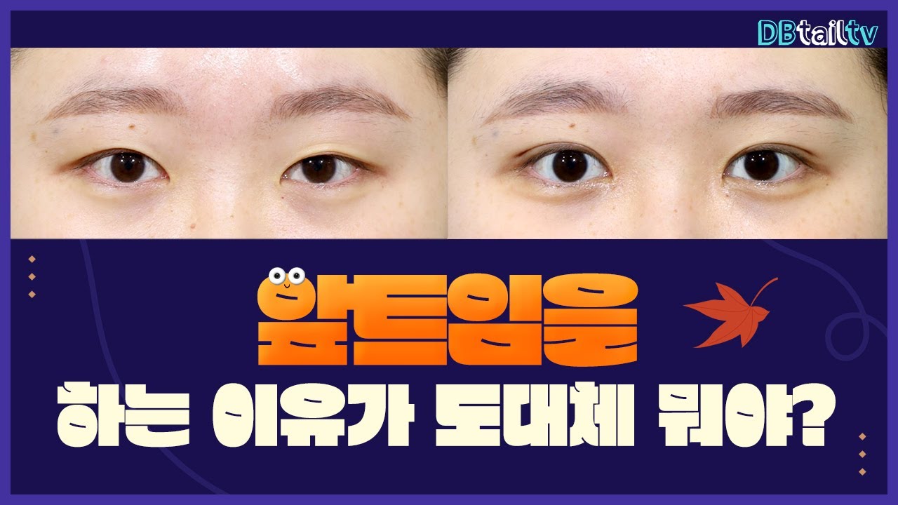 앞트임을 하는 이유가 도대체 뭐야?