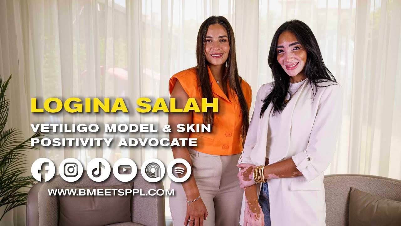 B Meets Logina Salah's Inspiring Vitiligo Journey
