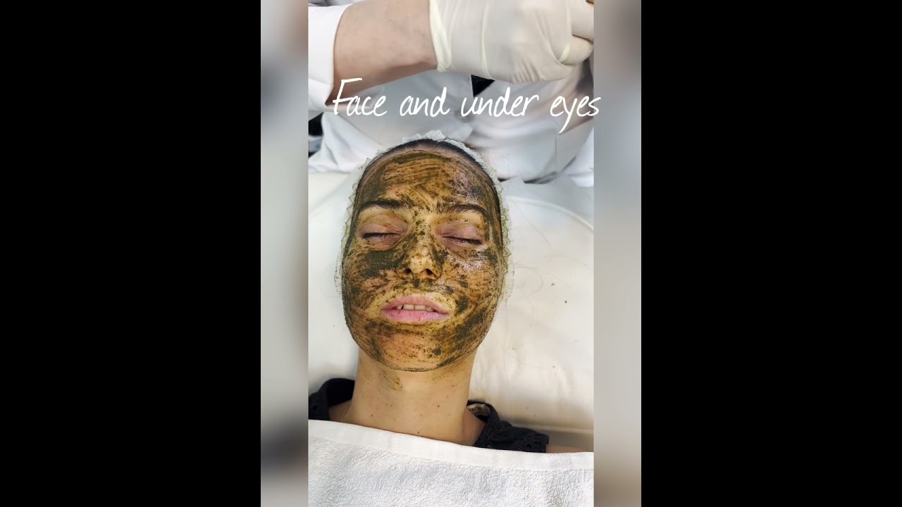 Green peel -Herbal peel for Acne, Acne scars, Enlarged pores, Wrinkles, Stretch marks, Pigmentation