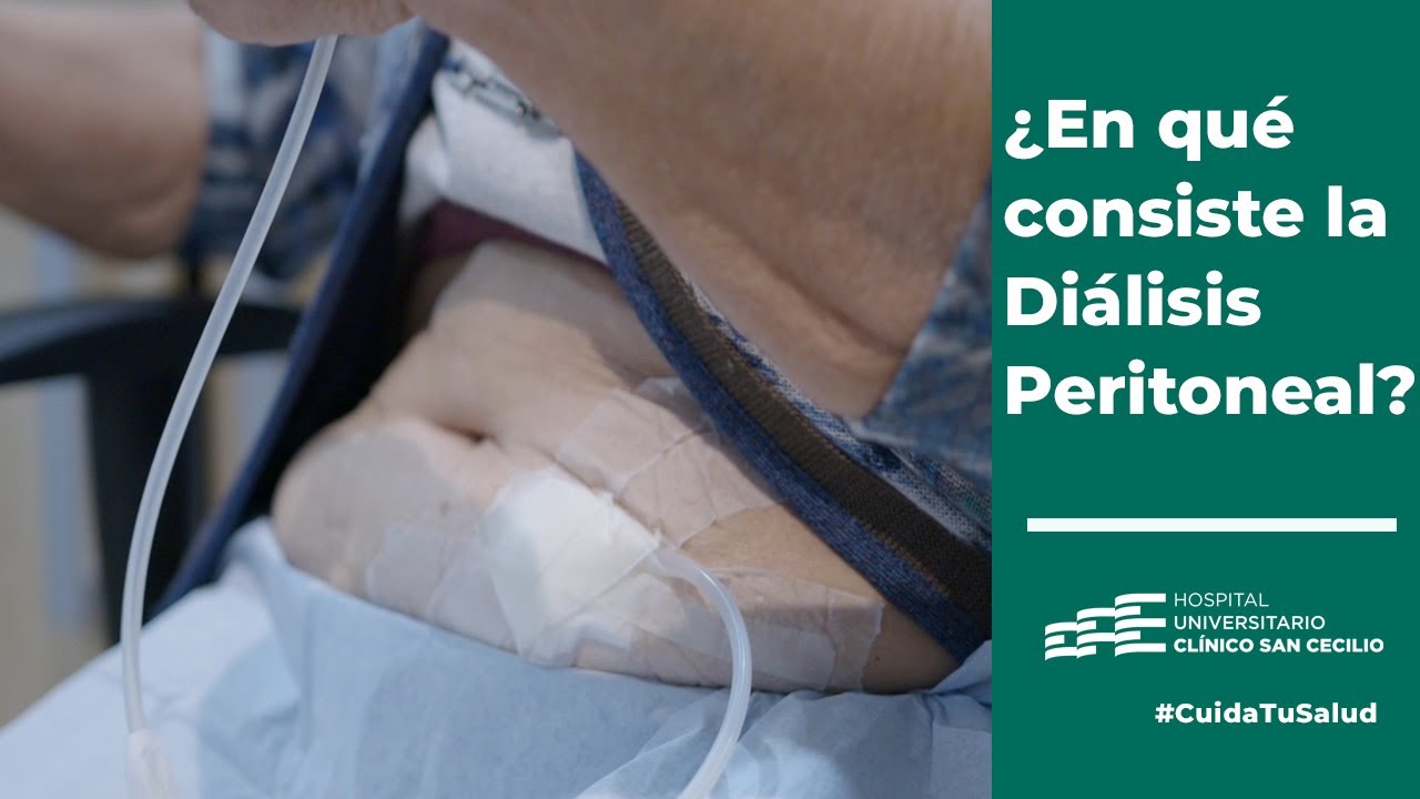 Diálisis peritoneal: ¿qué es y en qué casos es necesaria? - #cuidatusalud