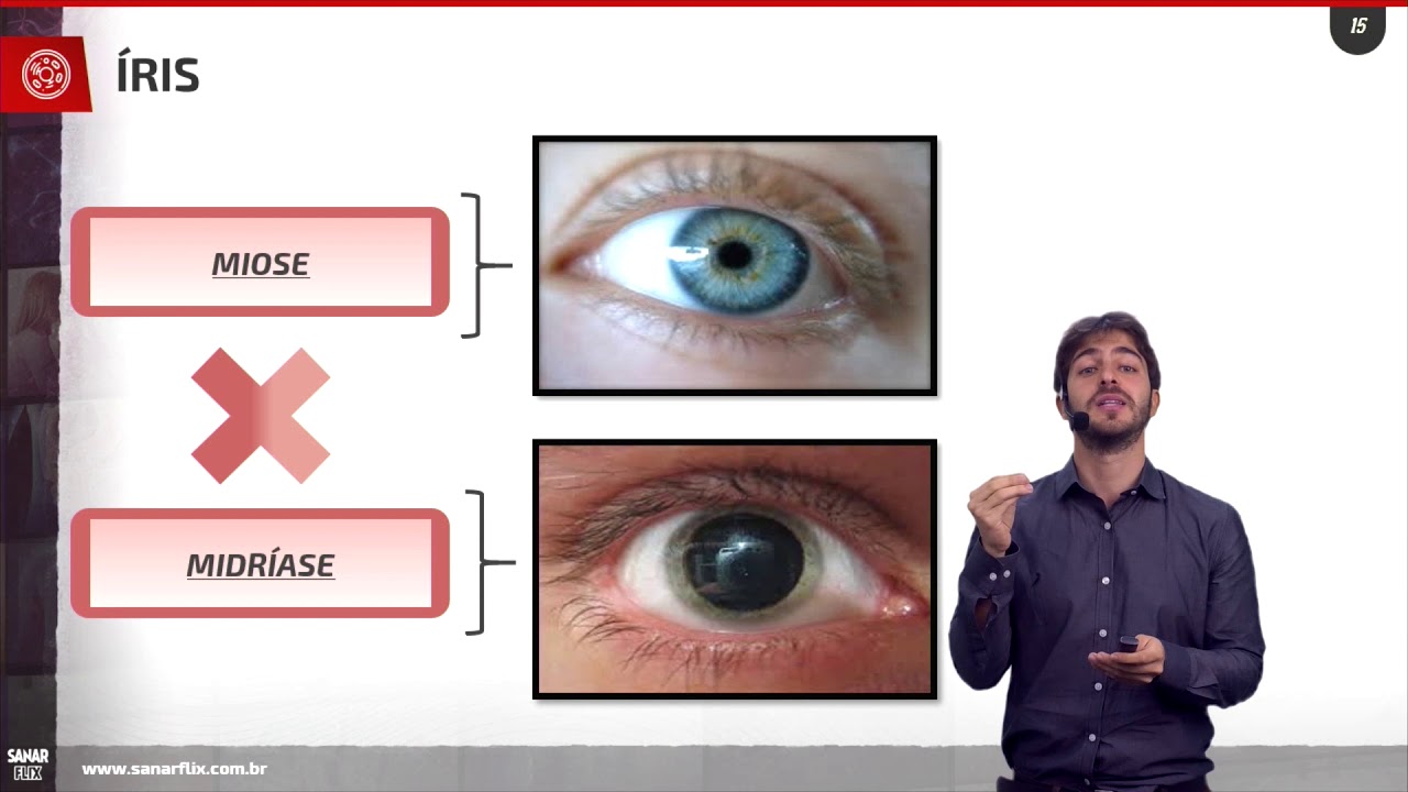 Anatomia e fisiologia dos olhos - Aula SanarFlix