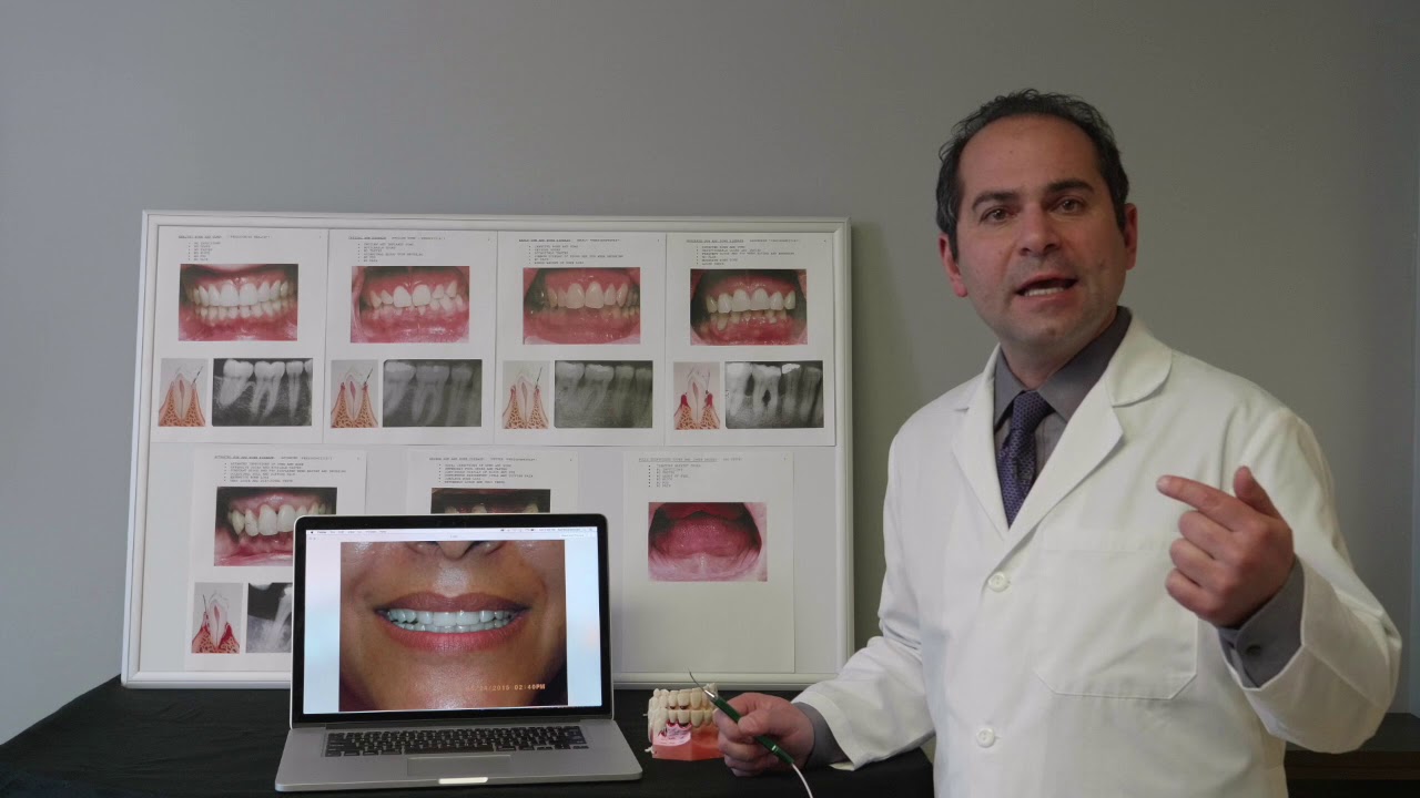 Dental Bone Grafting - Lanap