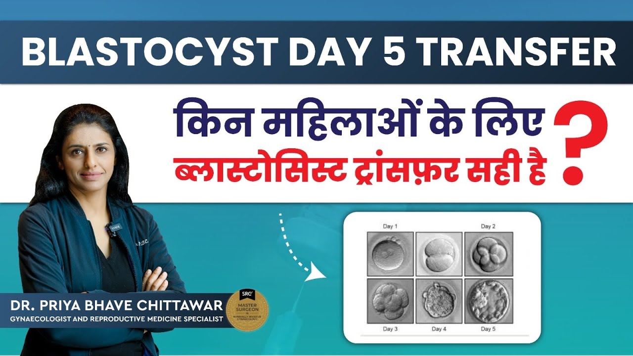 Blastocyst Day 5 transfer किन महिलाओं के लिए ब्लास्टोसिस्ट ट्रांसफ़र सही है? ByDrPriyaBhaveChittawar