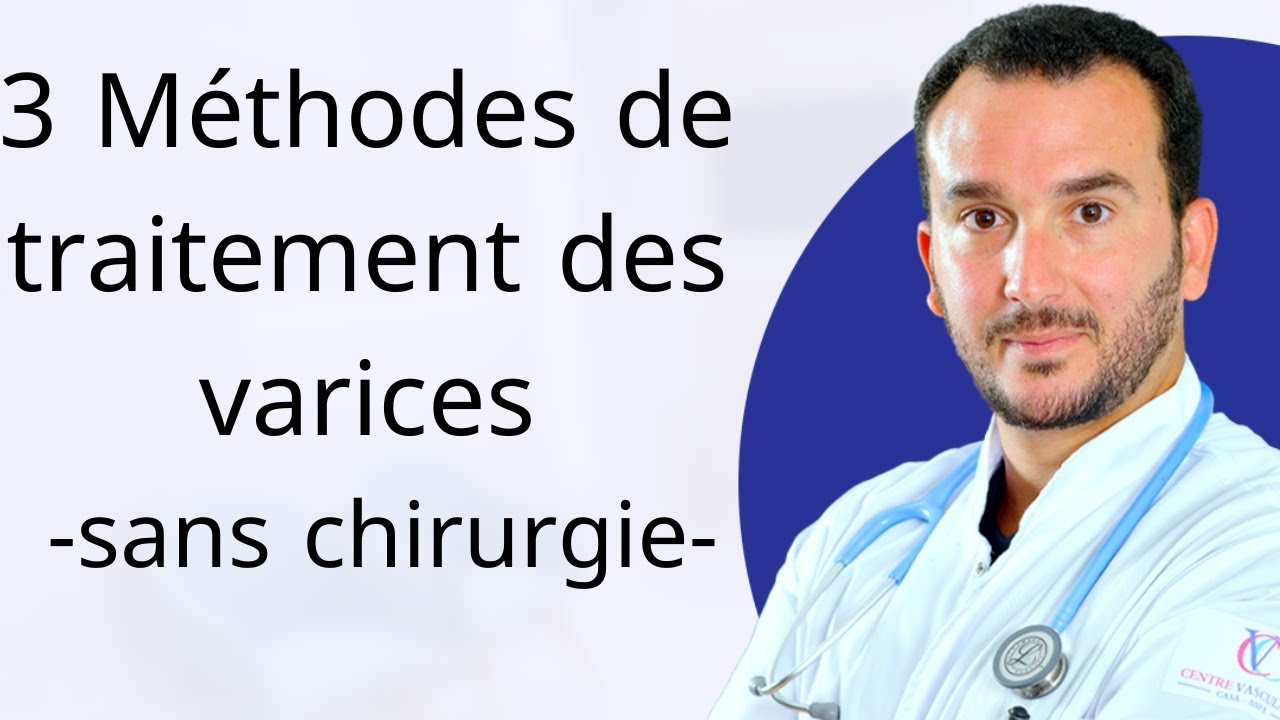 Diagnostic des varices et derni&egrave;res m&eacute;thodes de traitements avec le chirurgien vasculaire angiologue