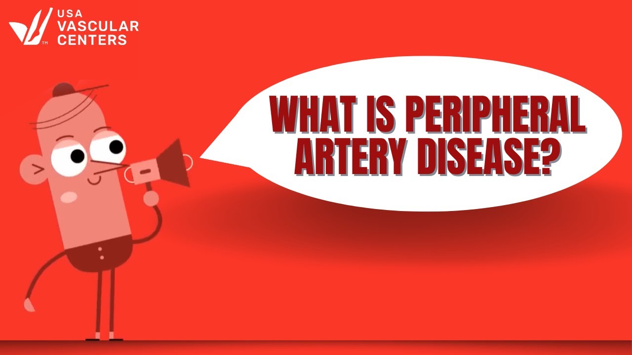 What is Peripheral Artery Disease?