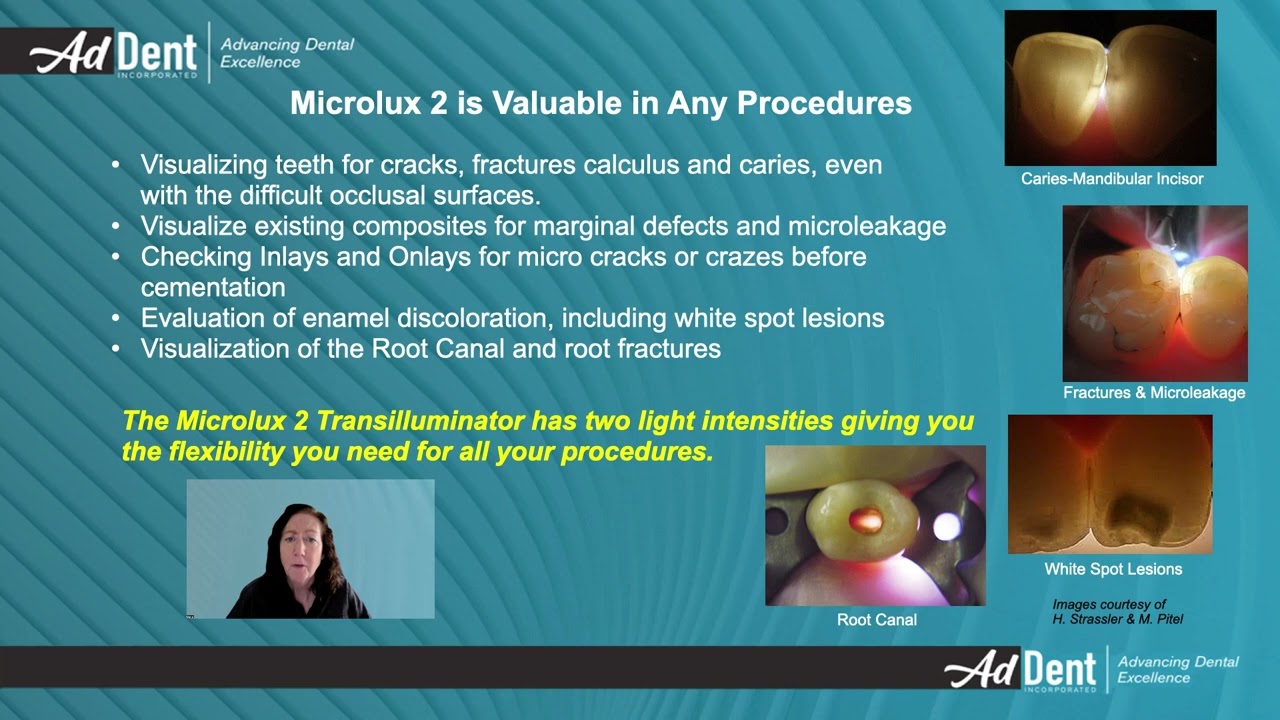Microlux 2 Presentation