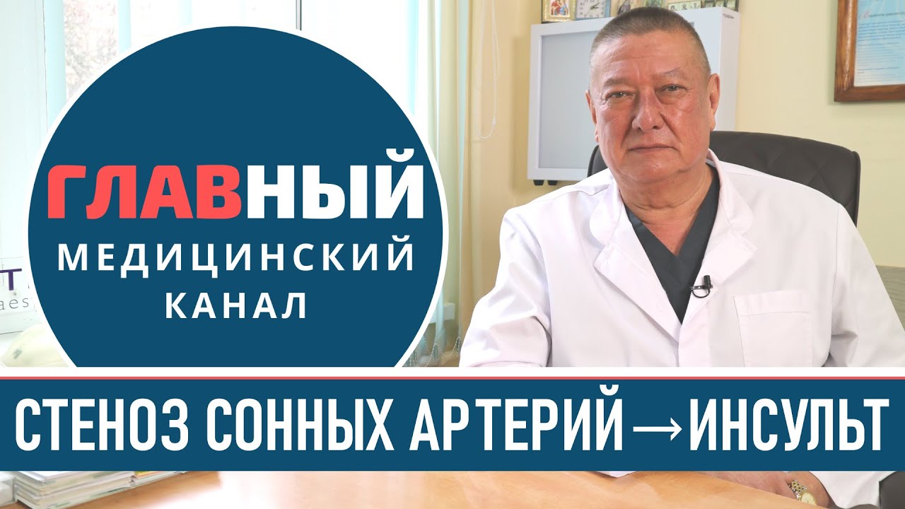 Стеноз сонной артерии: симптомы и лечение стеноза. Атеросклеротический стеноз сонных артерий