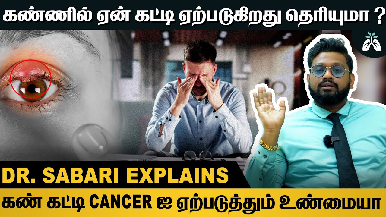 #கண் கட்டி வந்தால் முதலில் இதை செய்யுங்கள் | Dr Sabarinath Ravichandar Explains #stye #eyes