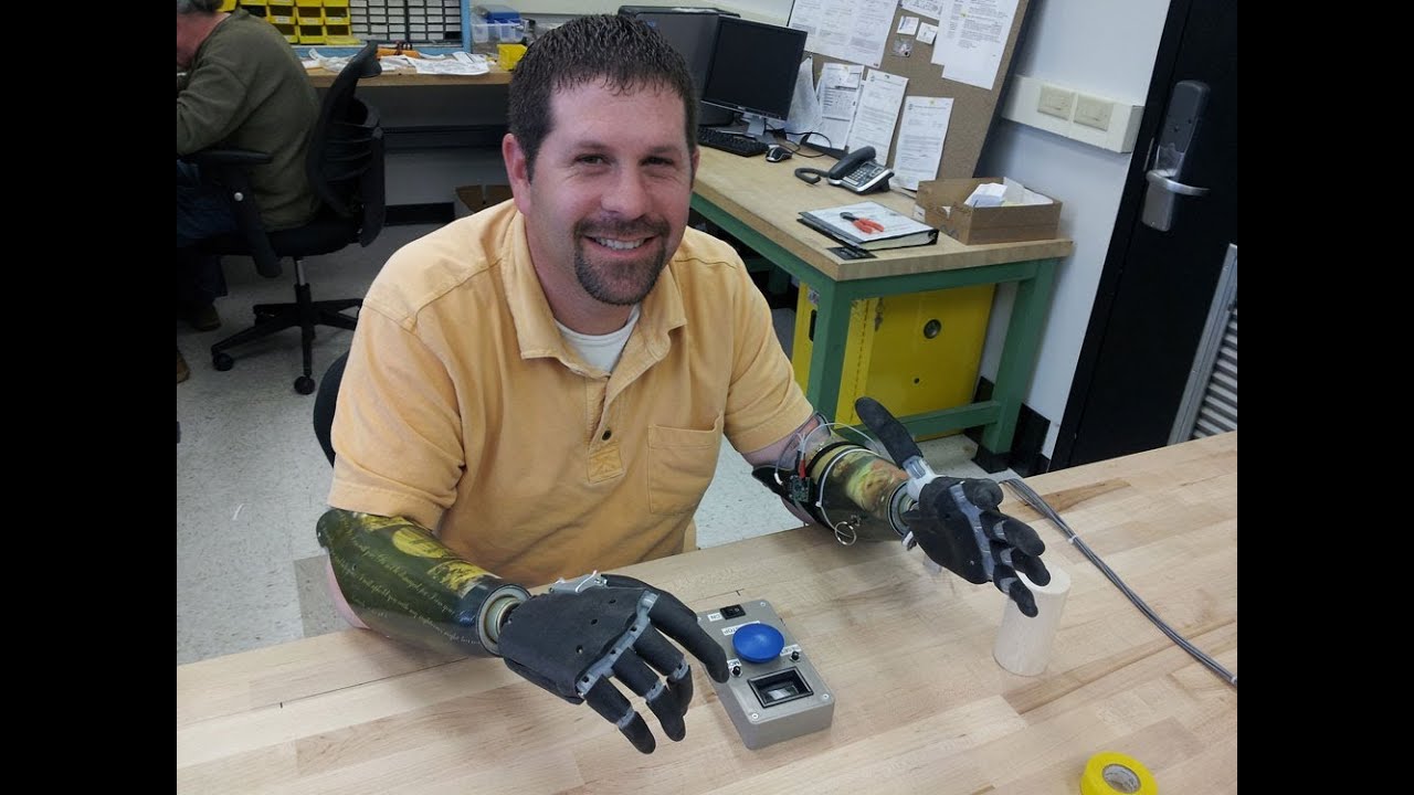 Bionic Breakthrough: Advances in this robotic hand; get a special view of Commodore baseball