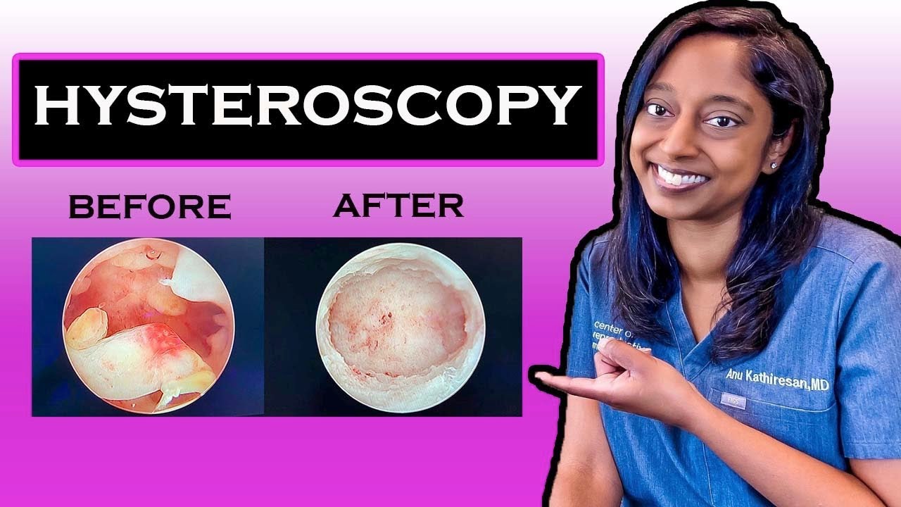 HYSTEROSCOPY