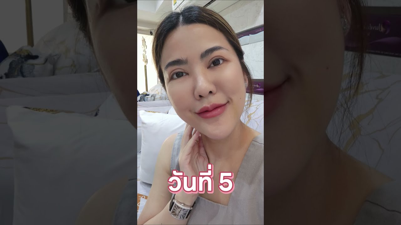 ฉีดฟิลเลอร์กินของแสลง แอลกอฮอล์ได้ไหมหรือไม่