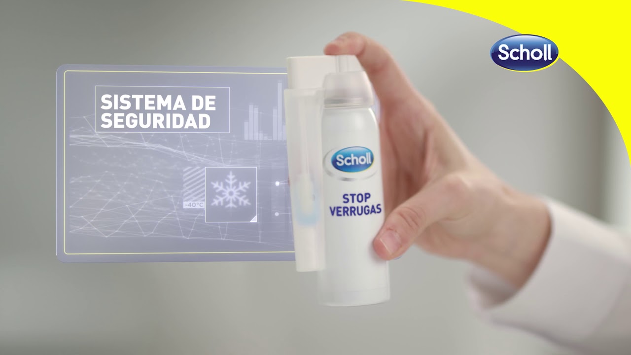 C&oacute;mo quitar un papiloma en el pie