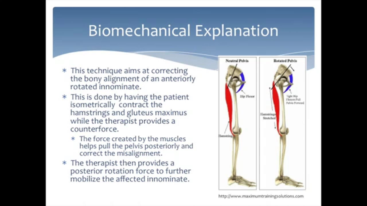 Mobilization to correct an Anterior Innominate rotation of the pelvis: Physical Therapy