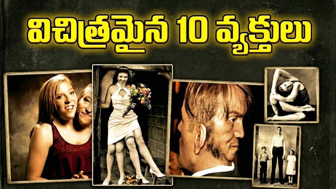 Top 10 Amazing People In The World | Born With Abnormality | RAR Facts