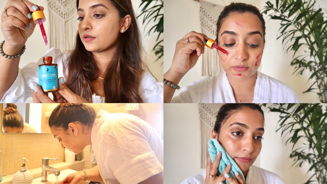 My First Chemical Peeling At Home | Pilgrim Product Experience
