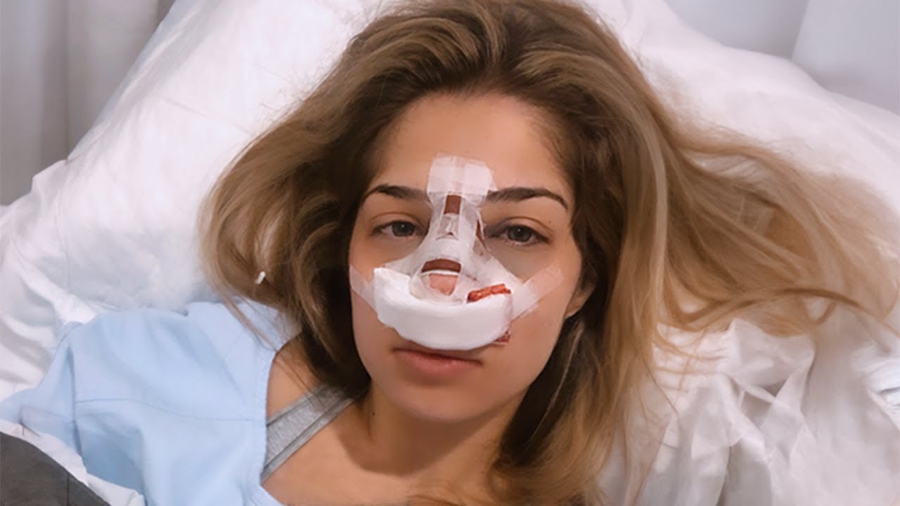 Τι Πλαστικές Έχω Κάνει