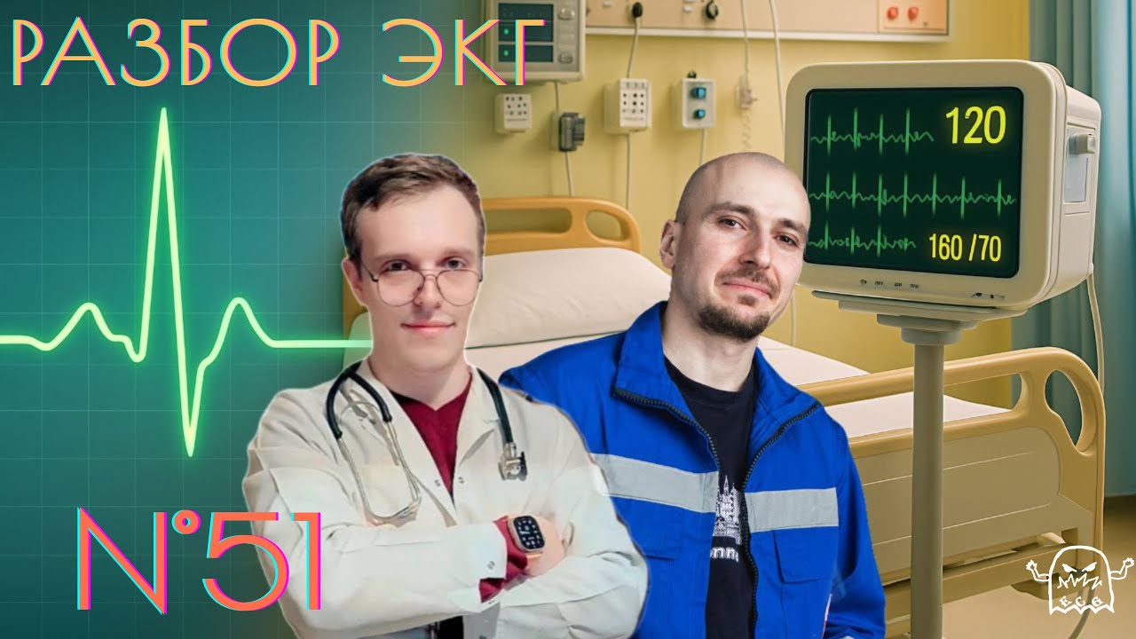 Разбор ЭКГ № 51