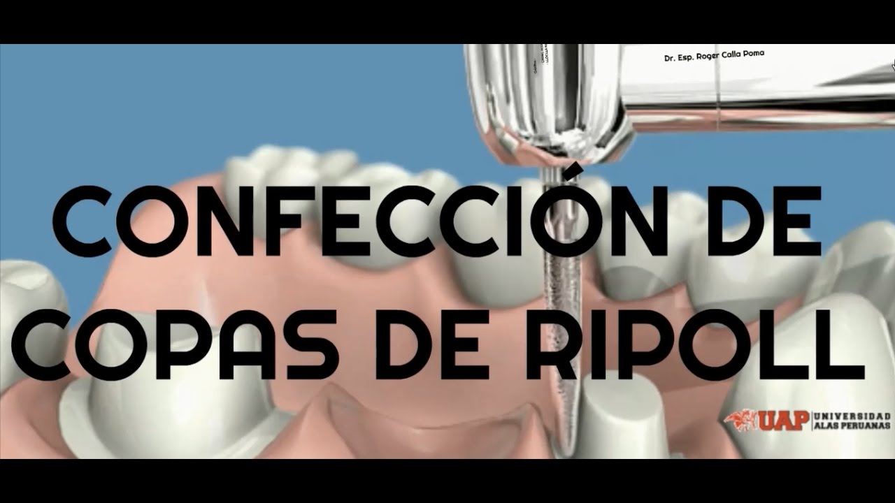 Dr. Esp. Roger CALLA - CONFECCIÓN DE COPAS DE RIPOLL