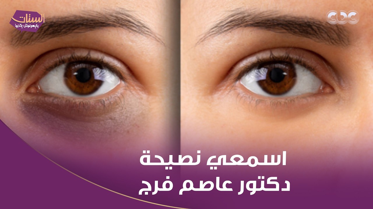 الستات مايعرفوش يكدبوا | مش هيبقى فيه هالات سودا تاني خلاص بسبب السهر في رمضان وقلة شرب المياه