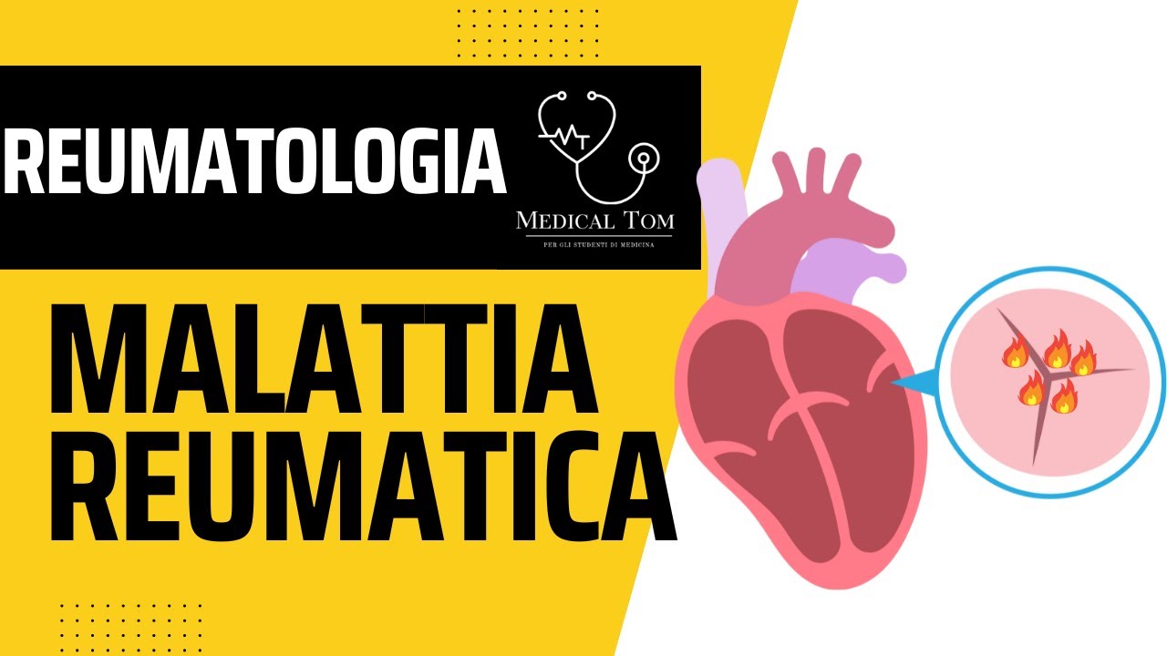 Malattia Reumatica | Generalità, Fisiopatologia, Diagnosi e Trattamento
