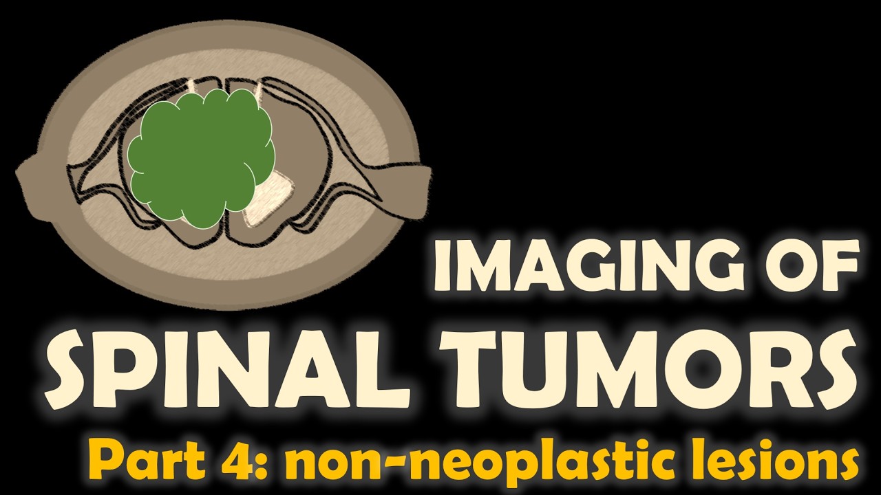 Imaging of spinal tumors, part 4: non-neoplastic lesions