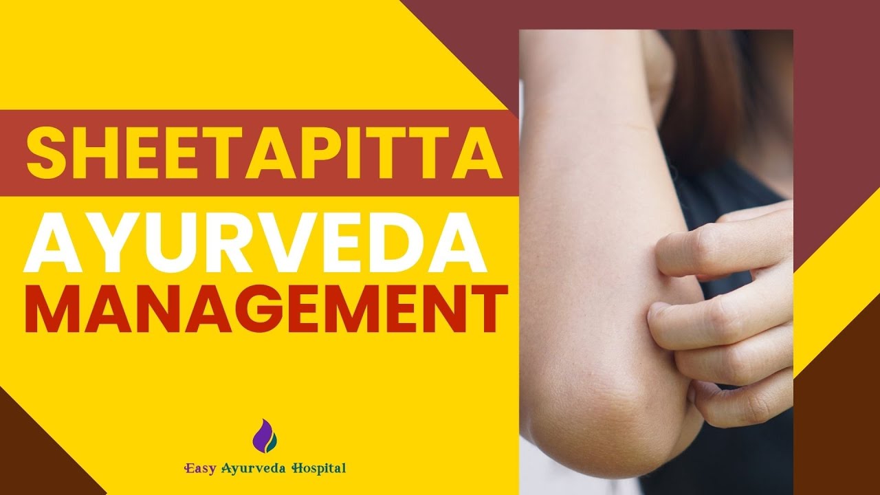 Hives Ayurveda Remedy| Ayurveda medicines for Hives| Sheethapitta Ayurveda Treatment