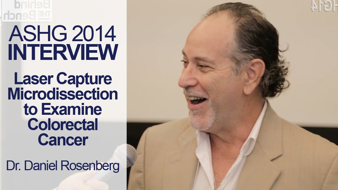 Examining Colorectal Cancer Using Laser Capture Microdissection - ASHG 2014