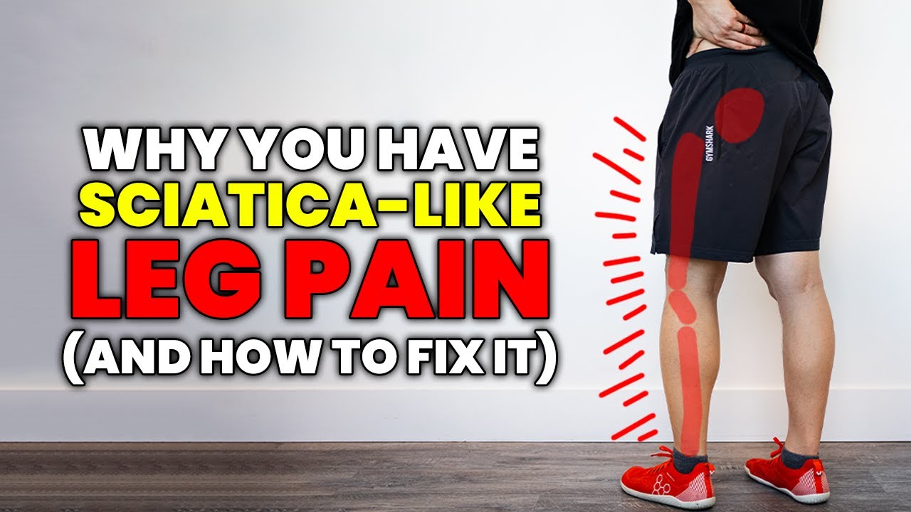 It's Referral Pain not Sciatica! How the gluteus minimus can mimic sciatica and how to fix it