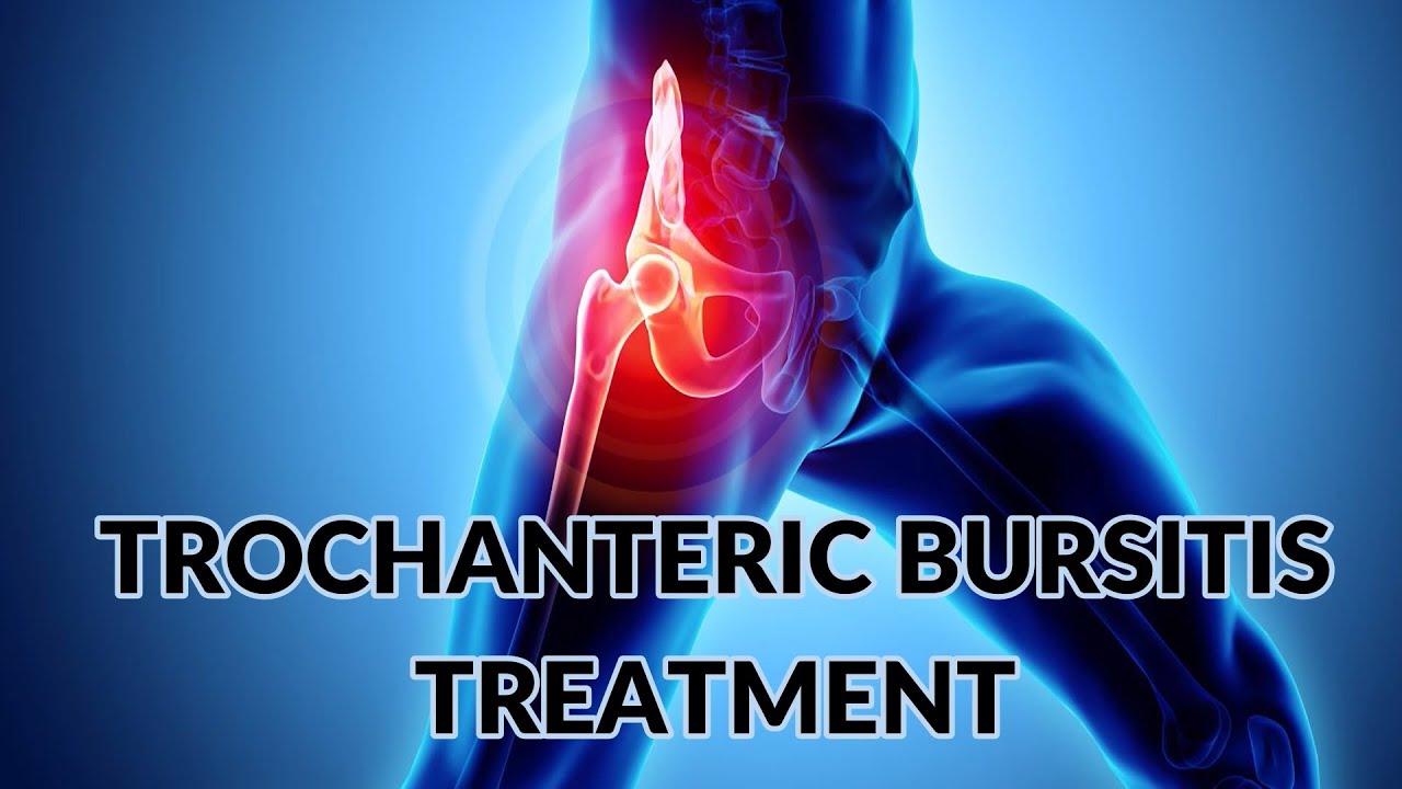 ShockWave Dual Power - Trochanteric Bursitis