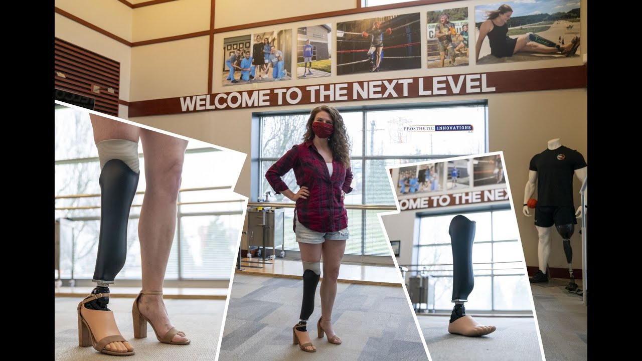 High Heel Prosthetic Foot | Ossur Proflex Align | Prosthetic Innovations
