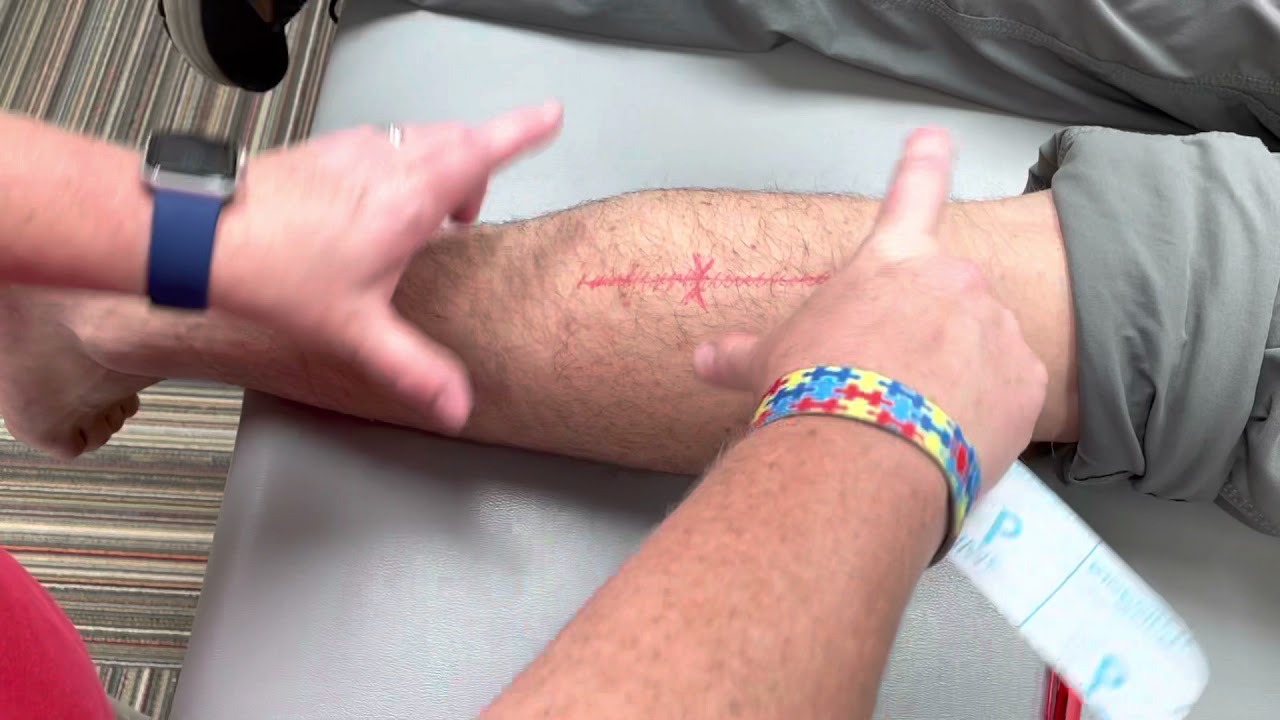 Kinesiotaping for scars