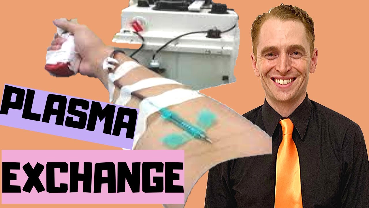 Plasma Exchange for Multiple Sclerosis