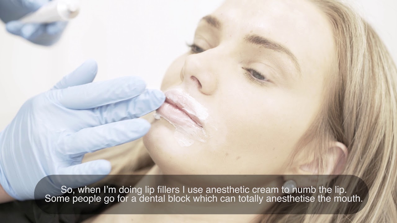 Lip Fillers
