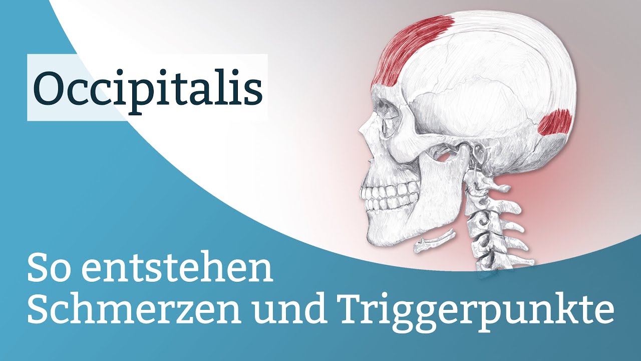Occipitalis Schmerzen, Triggerpunkte und deren Aktivierung