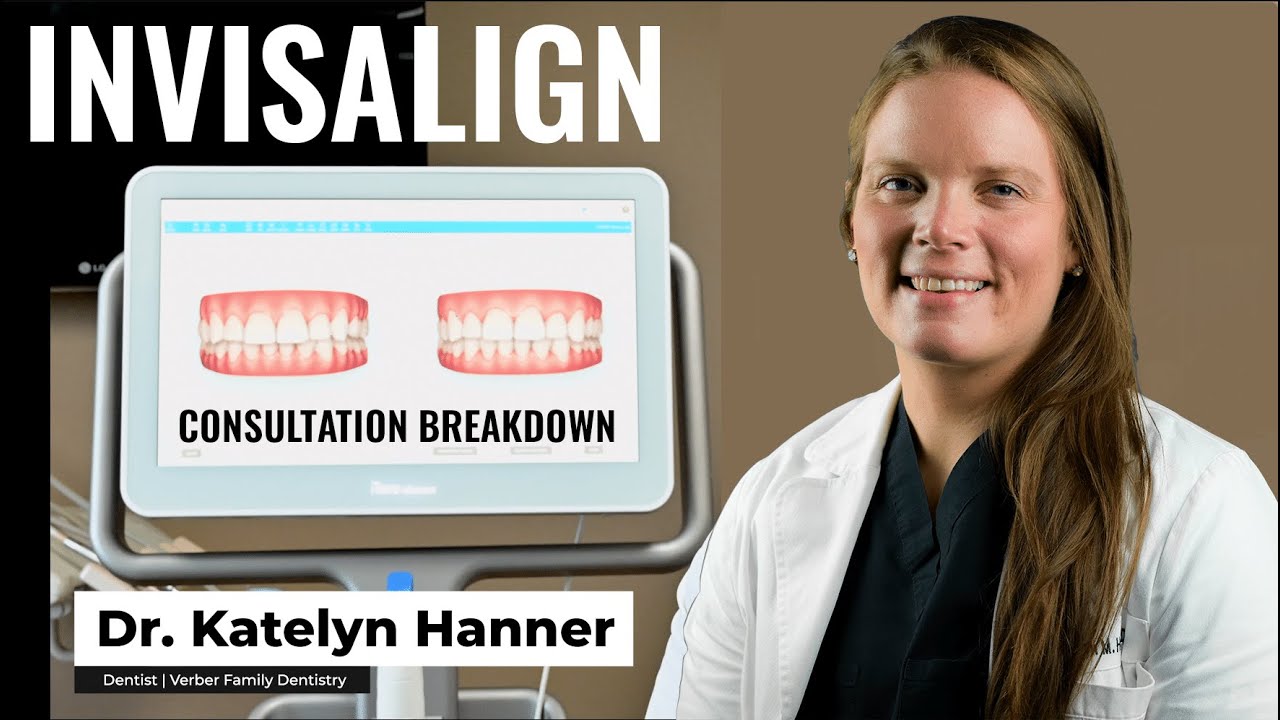 Invisalign Consultation Breakdown