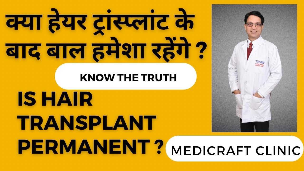 Transplanted Baal kitna chalte hain  I Are transplanted hairs permanent I Age of transplanted hairs