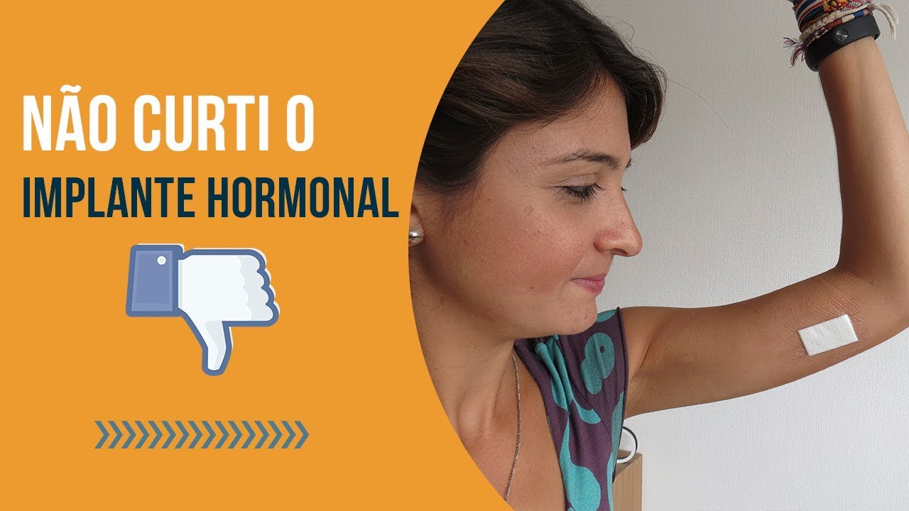 Minha experiência NEGATIVA com o IMPLANTE HORMONAL