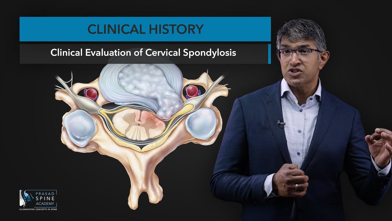 Obtaining a Good Clinical History in Cervical Spine Evaluation