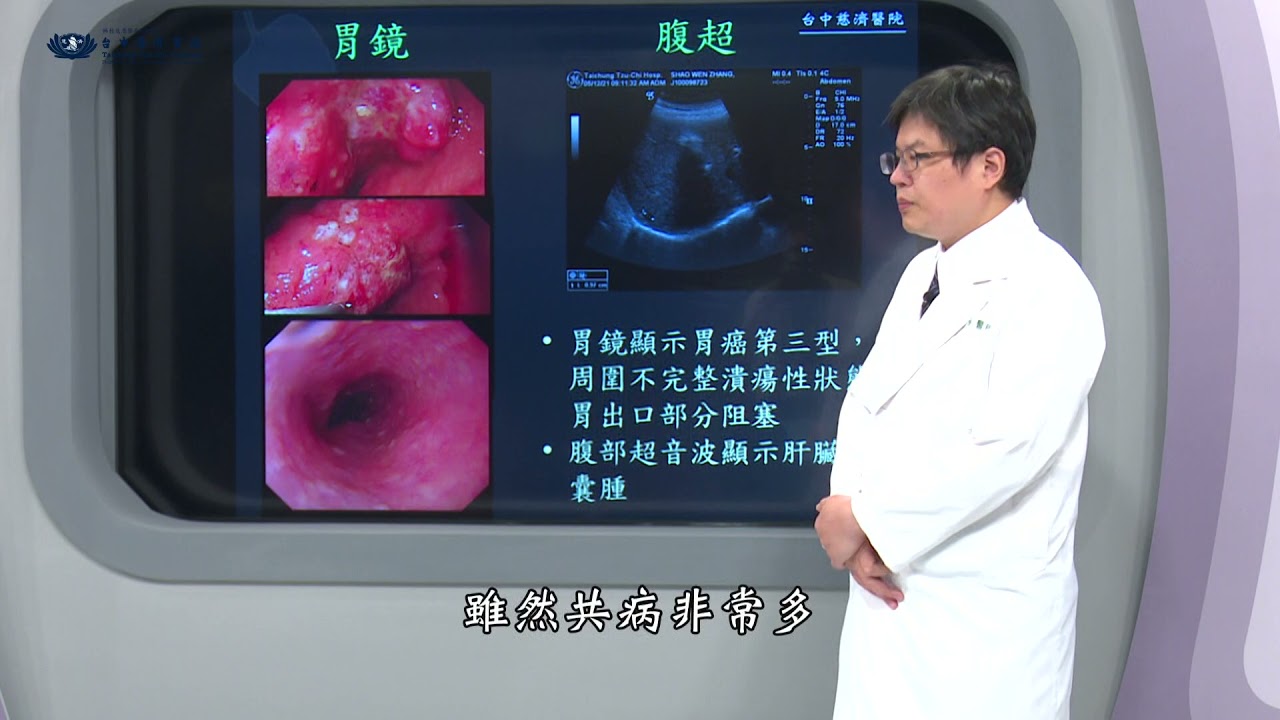 臺中慈濟醫院特色醫療－一般外科＼胃癌診治停看聽(二)
