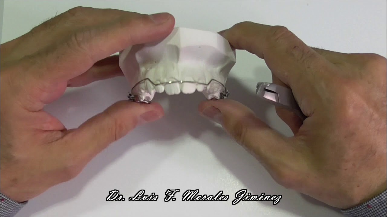 ARCO UTILITARIO BASICO DE RICKETTS
