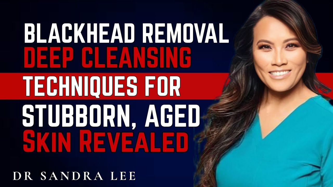 Blackhead Removal &mdash; Deep Cleansing Techniques for Stubborn, Aged Skin Revealed.[DR SANDRA LEE]