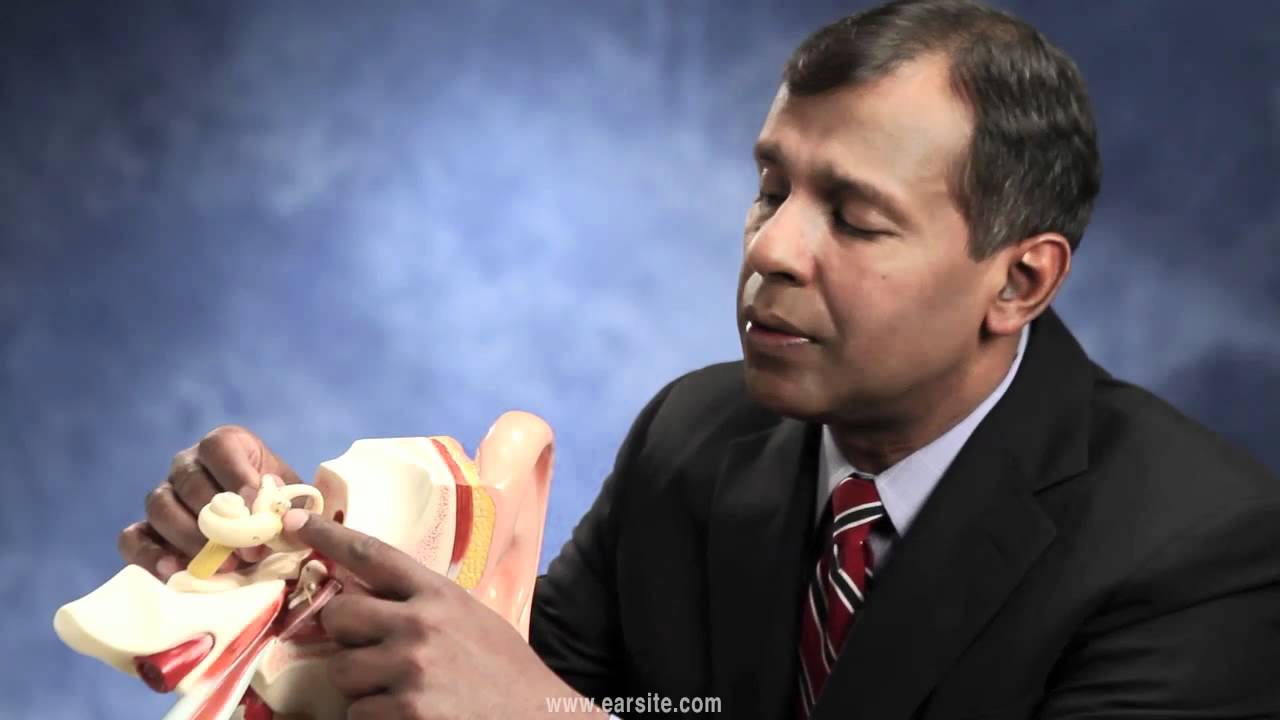 Stapedectomy