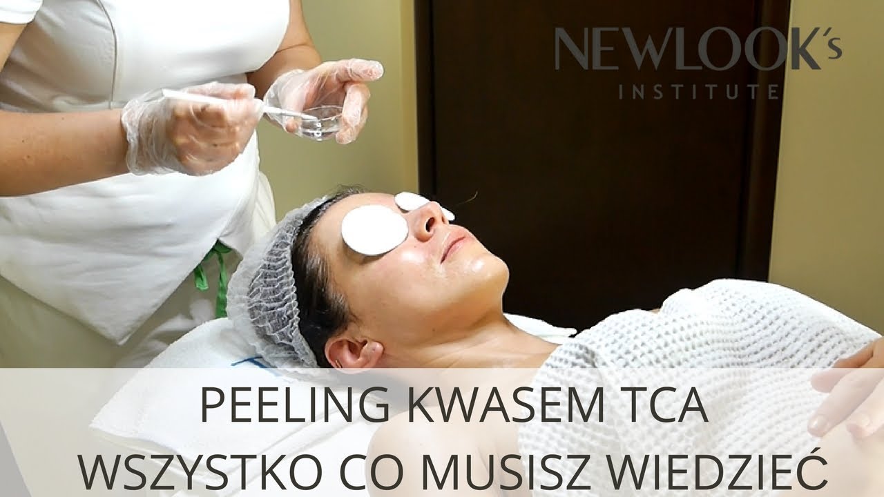 Peeling kwasem TCA - wskazania, przebieg i efekty peelingu chemicznego