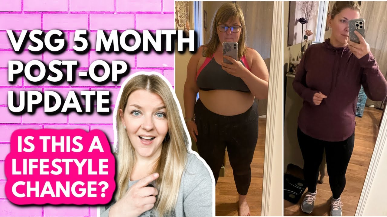 VSG 5 MONTHS POST-OP UPDATE | 100lbs Weight Loss Journey with Gastric Sleeve Weight Loss Surgery