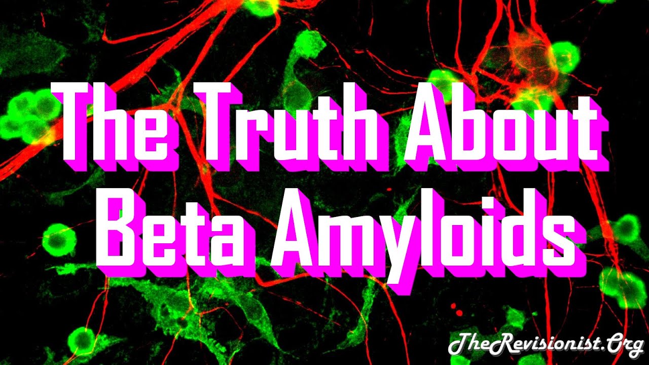 About Beta Amyloid Types, Functions, Monomeric vs Oligomeric A&beta; in Alzheimer's Disease - Part 3